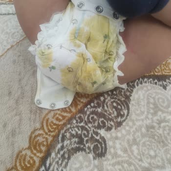 Sleepy Sızdırıyor Alerji Yapıyor Kalitesiz