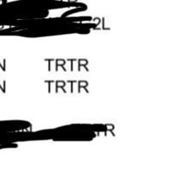 Kuşadası Beyaz Diş Polikliniğinde Yaşadığım Başarısız İmplant