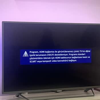 Bein Sports Servis Ağı Ücreti