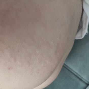 Uni Baby Bebek Cildine Zarar Veren Şampuan Deneyimi