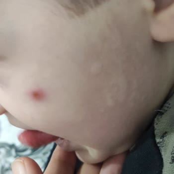 Uni Baby Bebek Cildine Zarar Veren Şampuan Deneyimi
