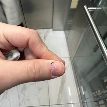 Duygu Acar Beauty Center Müşteri Memnuniyetsizliği