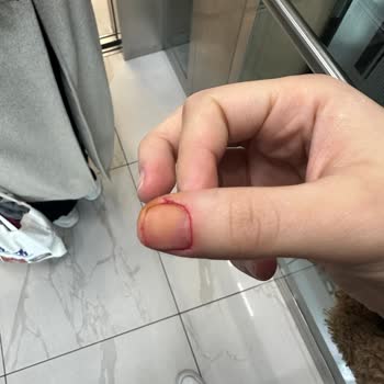 Duygu Acar Beauty Center Müşteri Memnuniyetsizliği