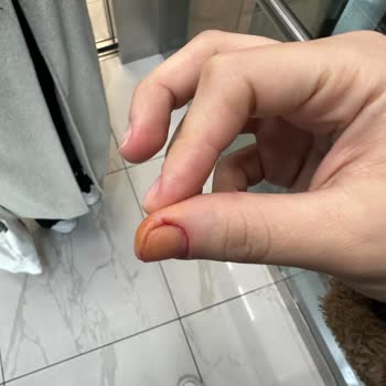 Duygu Acar Beauty Center Müşteri Memnuniyetsizliği