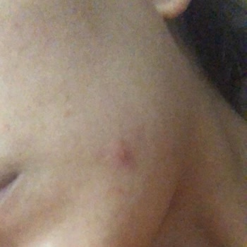 The Purest Solutions Mavi Tonik