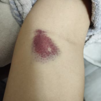 Necmettin Erbakan Üniversitesi Meram Tıp Fakültesi Hastanesi Konya'da Meram Tıp Fakültesi Kan Alma Biriminde Hemşirenin Yaptığı