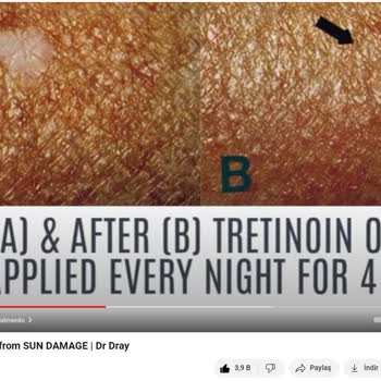 Çekmeköy Tıp Merkezi Cildiye Güneş Lekesine Bile Tanı Koyamıyor