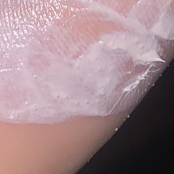 Procsin Çok Kırıldığım Bir Durum