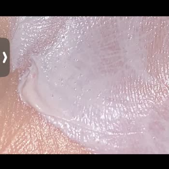 Procsin Çok Kırıldığım Bir Durum