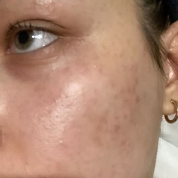 Watsons Banila Co Zero Yüzümü Mahvetti