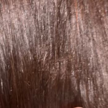 Babyliss Saçımda Ciddi Bir Yanık Var