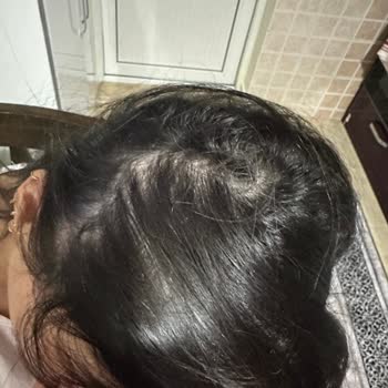 Urban Care Saç Spreyi Saçımı Beyazlattı