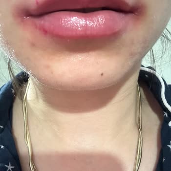 Nyx Duck Plum Gloss Yara Yaptı