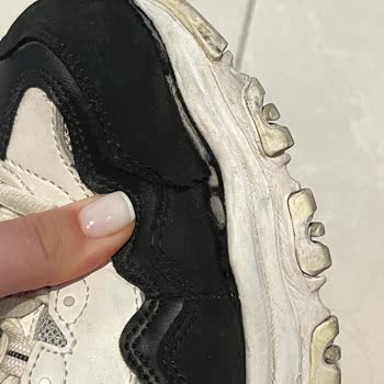 Skechers Ayakkabının Önleri Sadece 6 Ay Kullanımda Açıldı