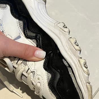 Skechers Ayakkabının Önleri Sadece 6 Ay Kullanımda Açıldı