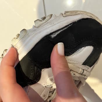 Skechers Ayakkabının Önleri Sadece 6 Ay Kullanımda Açıldı