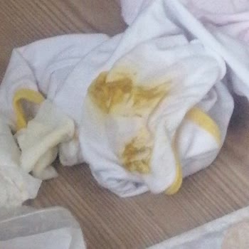 Baby Turco Bebek Bezinin Kakayı Çişi Emmemesi