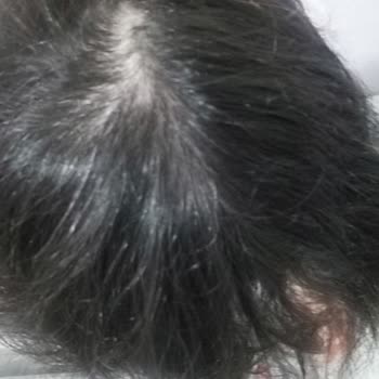 Urban Care Tonik Saçları Beyazlatıyor!