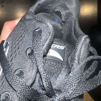 Skechers Ayakkabı Kalite Problemi