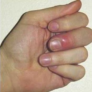 Nail. By_th Steril Değil