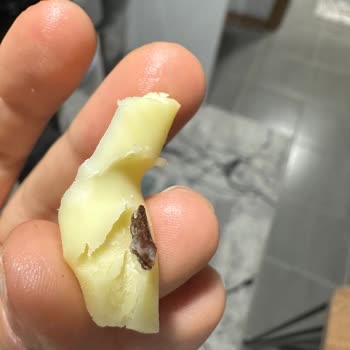 Aknaz Peynirin İçinde Yabancı Cisim