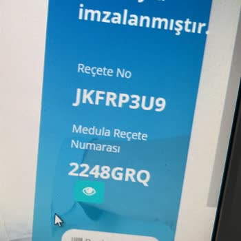 Skechers Spor Ayakkabı Sorunu