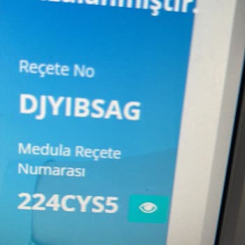 Skechers Spor Ayakkabı Sorunu