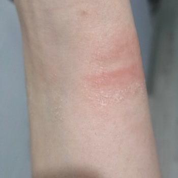 Samsung Telefon Samsung Arızalı Diye Gönderilen Watch 5'i Açma Gereği Bile Duymadı