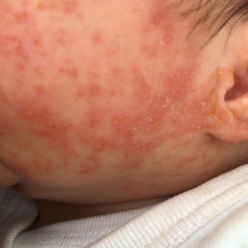 Mustela Yenileyici Krem Kötü