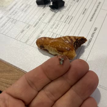 Kafkas Pasta Şekerleme Ay Çöreğinden Metal Parçası Çıkar Yakışmadı Kafkas