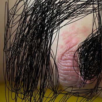 Molfix Pure & Soft Pişik Yaptı