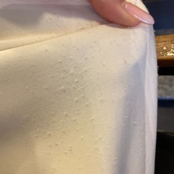 Zara Üründe Tüylenme Oluştu