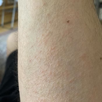 Bioderma Krem Cildimi Kabarttı
