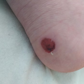 FLO Mağazası Ayağım Parçalandı Ayakkabı