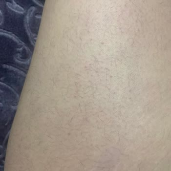 Dr. Well Tek Kelimeyle Pişmanlık