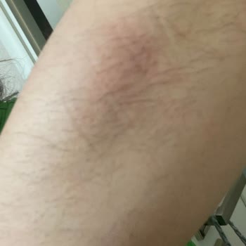 Dr. Well Tek Kelimeyle Pişmanlık