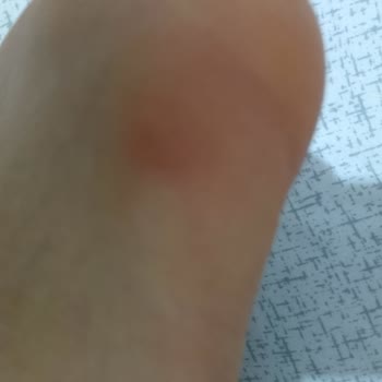 Lumberjack Ayakkabı Yüzünden Ayağımızdan Olacağız