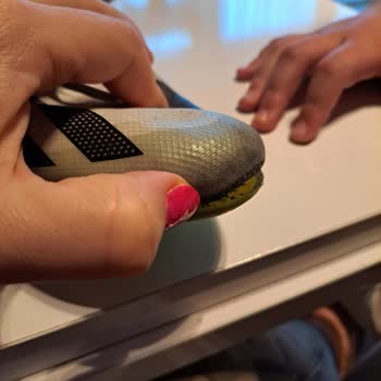 Adidas Spor Ayakkabı 3 Aydan Sonra Görüntü