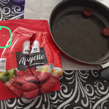 Maret Sucuk İçinden Sert Cisim Çıkması