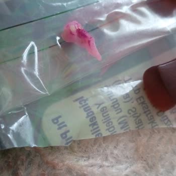 A101 Pıt Pıt Jelibon İçinden Çıkan Yabancı Madde