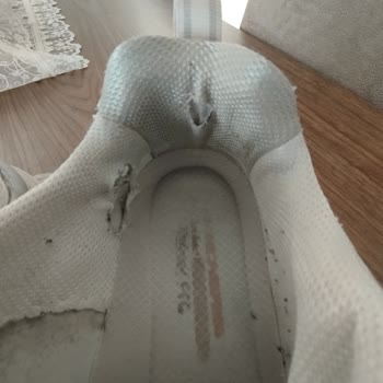 Skechers Sporayakkabı Daki Bozulmalar.