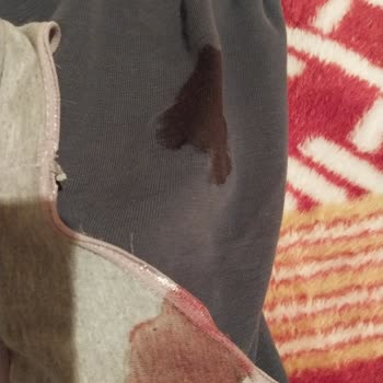 Akademi Hastanesi (Mersin) Paranla Rezil Olmak Böyle Bir Şey Hiç Anlatılamazdı Teşekkürler