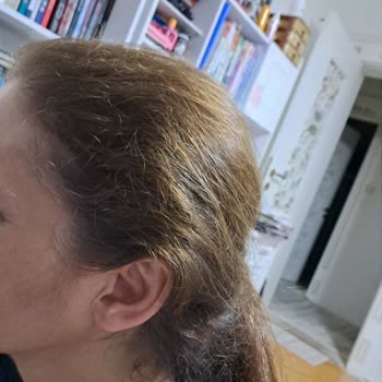 Loreal Paris Saç Boyasının Renk Sorunu