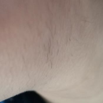 Bahar Acar Güzellik Merkezi Olmayan Tüylerimi Sakala Çevirdi!