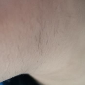 Bahar Acar Güzellik Merkezi Olmayan Tüylerimi Sakala Çevirdi!