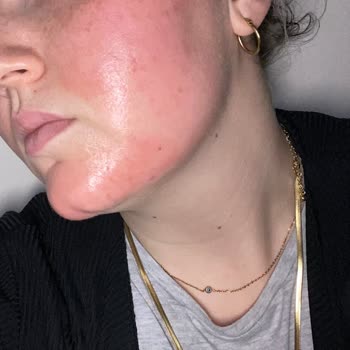 Estate Cosmetics Cilt Hassasiyetine Yol Açan Maske Sorunu