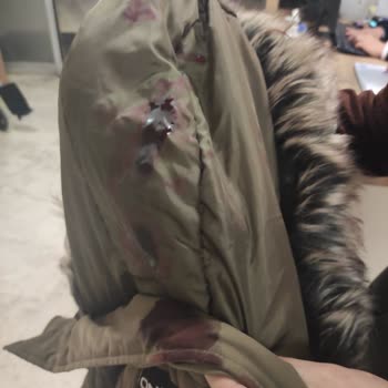 B7 Clinics Kök Hücre Tedavisi Sonrası Yaşanan Sorunlar