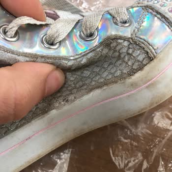 Skechers Ayakkabı 3 Ayda Ne Hale Geldi. Garanti Kapsamı Sıfır.