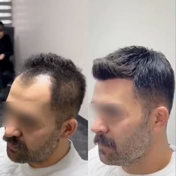 Eki aç