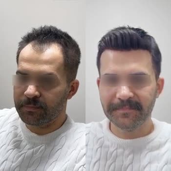 Eki aç